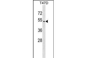 ZN Antibody (Center) (ABIN1537791 and ABIN2849457) western blot analysis in T47D cell line lysates (35 μg/lane). (ZNF713 Antikörper  (AA 122-149))