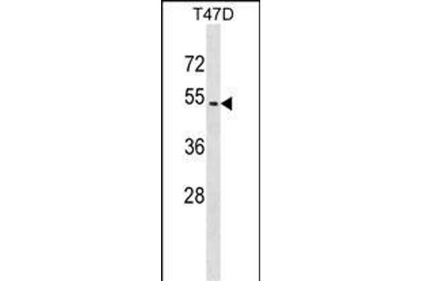 ZNF713 Antikörper  (AA 122-149)
