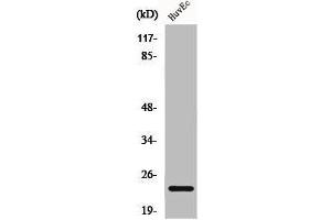 Western Blot analysis of HuvEc cells using Caveolin-1 Polyclonal Antibody (Caveolin-1 Antikörper  (C-Term))