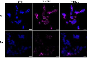 Immunocytochemical staining of HeLa cells using LMAN1 antibody (ABIN7799244), 1:1,000), Top panel: wild-type (WT), Bottom panal: LMAN1 shRNA knockdown (KD).