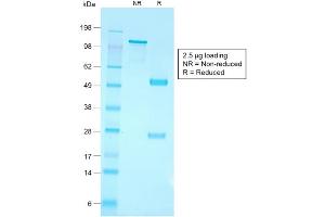 SDS-PAGE Analysis of Purified CD79a Rabbit Recombinant Monoclonal Antibody ABIN6383859. (Rekombinanter CD79a Antikörper  (AA 202-216))
