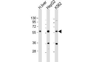 All lanes : Anti-NAGS Antibody (Center) at 1:1000 dilution Lane 1: human liver lysate Lane 2: HepG2 whole cell lysate Lane 3: K562 whole cell lysate Lysates/proteins at 20 μg per lane. (NAGS Antikörper  (AA 275-309))