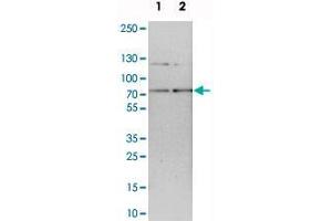 Western blot analysis of cell lysates with RNGTT polyclonal antibody . (RNGTT Antikörper)