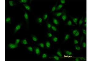 Immunofluorescence of monoclonal antibody to XAB2 on HeLa cell.