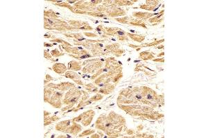 Immunohistochemistry (Paraffin-embedded Sections) (IHC (p)) image for anti-Nestin (NES) (AA 1389-1416) antibody (ABIN388764)