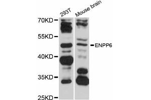 Western blot analysis of extracts of various cell lines, using ENPP6 antibody (ABIN5997678) at 1/1000 dilution.