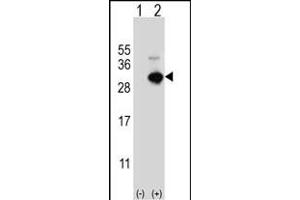Western blot analysis of GSTO1 (arrow) using rabbit polyclonal GSTO1 Antibody (Center) (ABIN389475 and ABIN2839537). (GSTO1 Antikörper  (AA 126-155))