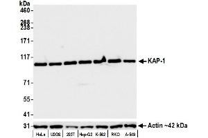 Western Blotting (WB) image for anti-Tripartite Motif Containing 28 (TRIM28) (Ser824) antibody (ABIN7454012)