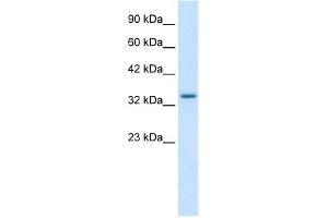 WB Suggested Anti-ZNF134 Antibody Titration:  1. (ZNF134 Antikörper  (Middle Region))