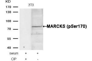 Western blot analysis of extracts from 3T3 cells, treated with serum or calf intestinal phosphatase (CIP), using MARCKS (phospho-Ser170) Antibody. (MARCKS Antikörper  (pSer170))