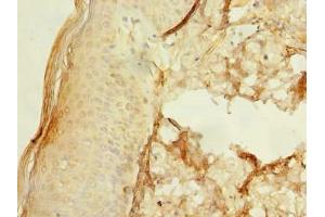 Immunohistochemistry of paraffin-embedded human skin tissue using ABIN7174599 at dilution of 1:100 (UBXN6 Antikörper  (AA 1-388))