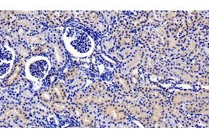 Immunohistochemistry (IHC) image for anti-Interleukin 22 Receptor, alpha 1 (IL22RA1) (AA 267-565) antibody (ABIN7439531)