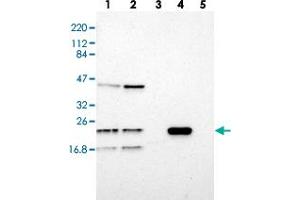 Western blot analysis of Lane 1: RT-4, Lane 2: U-251 MG, Lane 3: Human Plasma, Lane 4: Liver, Lane 5: Tonsil with LDOC1L polyclonal antibody  at 1:250-1:500 dilution. (LDOC1L Antikörper)