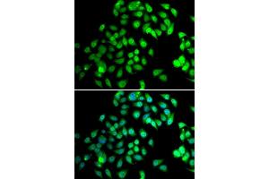 Immunofluorescence analysis of MCF7 cell using NCBP2 antibody. (NCBP2 Antikörper)