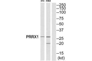 Western Blotting (WB) image for anti-Paired Related Homeobox 1 (PRRX1) (Internal Region) antibody (ABIN1851770) (PRRX1 Antikörper  (Internal Region))