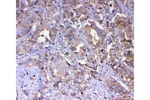 IHC analysis of IQGAP2 using antiIQGAP2 antibody (ABIN5692877). (IQGAP2 Antikörper  (AA 1329-1544))