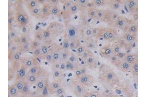 Detection of TOP3 in Human Liver Tissue using Polyclonal Antibody to Topoisomerase III (TOP3)