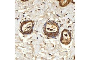 IHC analysis of SPTBN2 using anti-SPTBN2 antibody (ABIN7602111).