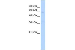 WB Suggested Anti-ITGBL1 Antibody Titration:  5. (ITGBL1 Antikörper  (N-Term))