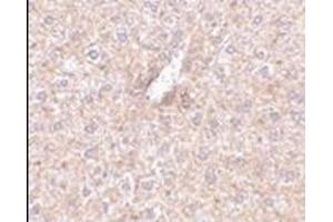 Immunohistochemistry of STEAP3 in mouse liver tissue with this product at 2. (STEAP3 Antikörper  (N-Term))