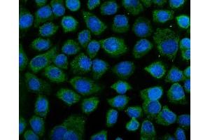 IF analysis of KEAP1 using anti-KEAP1 antibody (ABIN7602552).