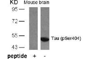 Image no. 1 for anti-Microtubule-Associated Protein tau (MAPT) (pSer404) antibody (ABIN196810) (MAPT Antikörper  (pSer404))