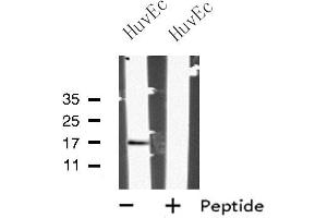 Western blot analysis of MRPL27 using HuvEc whole cell lysates (MRPL27 Antikörper  (Internal Region))