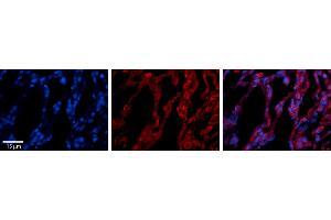 Immunohistochemistry (IHC) image for anti-Transporter 1, ATP-Binding Cassette, Sub-Family B (MDR/TAP) (TAP1) (Middle Region) antibody (ABIN2781498)