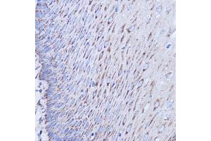 Immunohistochemistry (IHC) image for anti-Mitochondrially Encoded NADH Dehydrogenase 1 (MT-ND1) antibody (ABIN7268598)