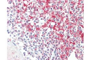 Anti-ADAM19 antibody IHC staining of human spleen.
