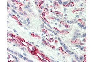 Anti-CASP2 / Caspase 2 antibody IHC of human placenta. (Caspase 2 Antikörper  (N-Term))