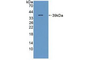 Western blot analysis of recombinant Rat ITaC. (CXCL11 Antikörper  (AA 22-100))