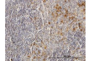 Immunostaining (ISt) image for anti-Fc Fragment of IgG, Low Affinity IIb, Receptor (CD32) (FCGR2B) (AA 1-310) antibody (ABIN515564)