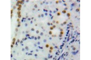 Used in DAB staining on fromalin fixed paraffin-embedded Kidney tissue (DNMT1 Antikörper  (AA 1343-1570))