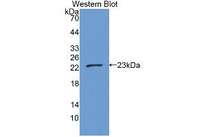 Western blot analysis of the recombinant protein. (CPT1B Antikörper  (AA 602-772))