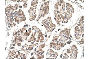 MOSPD3 antibody was used for immunohistochemistry at a concentration of 4-8 ug/ml to stain Skeletal muscle cells (arrows) in Human Muscle. (MOSPD3 Antikörper  (C-Term))
