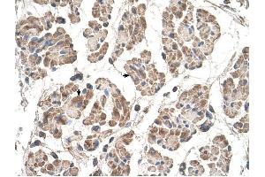 MOSPD3 antibody was used for immunohistochemistry at a concentration of 4-8 ug/ml to stain Skeletal muscle cells (arrows) in Human Muscle.