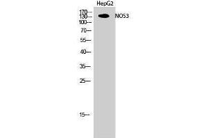 Western Blotting (WB) image for anti-Nitric Oxide Synthase 3 (Endothelial Cell) (NOS3) (Thr180) antibody (ABIN3185940) (ENOS Antikörper  (Thr180))