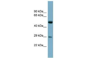 WB Suggested Anti-RAB27A Antibody Titration: 0. (RAB27A Antikörper  (Middle Region))