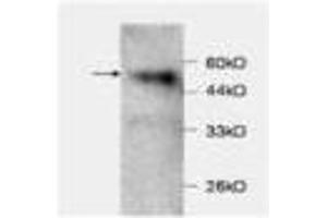 Image no. 1 for anti-Chemokine (C-C Motif) Ligand 2 (CCL2) antibody (ABIN791499) (CCL2 Antikörper)