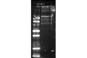 Goat anti Alpha-2-Macroglobulin antibody  was used to detect Alpha-2-Macroglobulin under reducing (R) and non-reducing (NR) conditions.