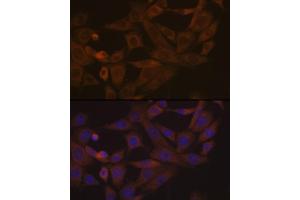 Immunofluorescence analysis of NIH-3T3 cells using Desmoglein 3 Rabbit mAb (ABIN7266741) at dilution of 1:100 (40x lens). (Desmoglein 3 Antikörper)