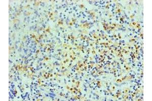 Immunohistochemical of paraffin-embedded human spleen using ABIN7168559 at dilution of 1:200 (S1A8 Antikörper)