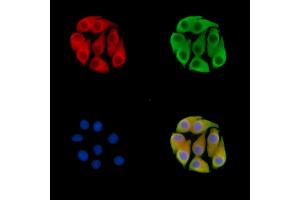 ABIN7095536 and ABIN7099593 staining Hela cells by IF/ICC.