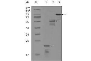 Western blot analysis using ERBB3 mouse mAb against truncated Trx-ERBB3 recombinant protein (1), MBP-ERBB3 (aa1175-1275) recombinant protein (2) and truncated ERBB3(aa665-1342)-hIgGFc transfected CH0-K1 cell lysate (3). (ERBB3 Antikörper  (AA 1175-1275))