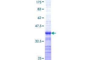 RNF10 Protein (AA 713-811) (GST tag)