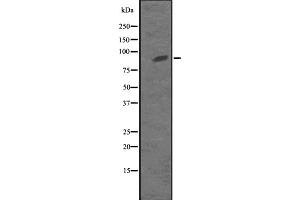 Western blot analysis of KIF23 expression in MKLP1 transfected 293T cell lysate,The lane on the left is treated with the antigen-specific peptide. (KIF23 Antikörper  (Internal Region))