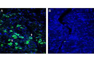 Expression of Platelet-activating factor receptor in rat substantia nigra pars compacta (SNC). (PTAFR Antikörper  (Extracellular))