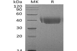 Western Blotting (WB) image for CD226 (CD226) protein (His tag) (ABIN7320734) (CD226 Protein (CD226) (His tag))