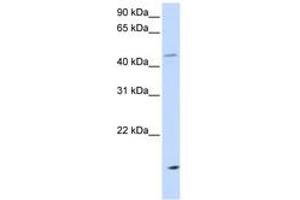 Image no. 1 for anti-Cholesteryl Ester Transfer Protein (CETP) (AA 36-85) antibody (ABIN6743588) (CETP Antikörper  (AA 36-85))